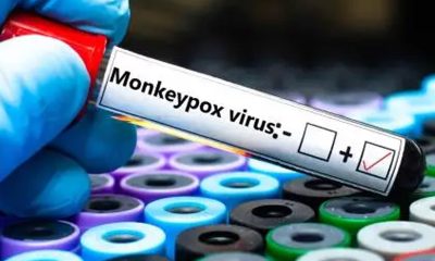 mpox
