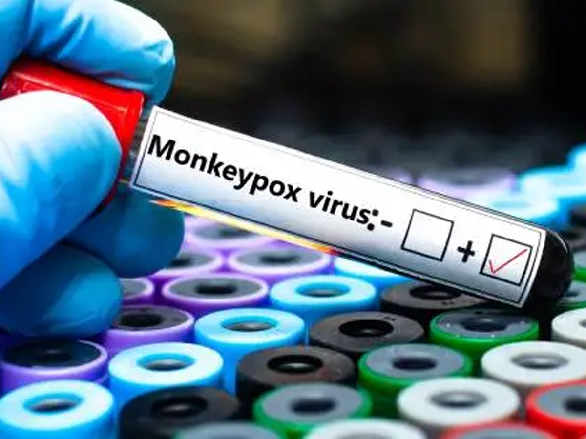 mpox