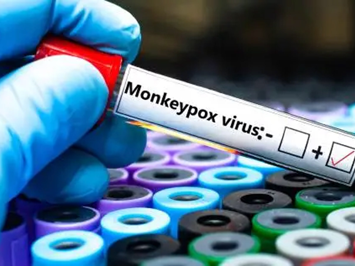 Mpox
